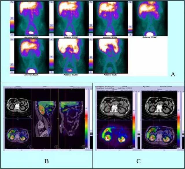 三个金币 视频海报