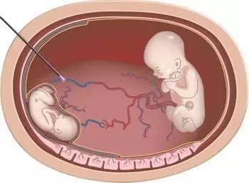 僵尸来袭2：末日 视频缩略图