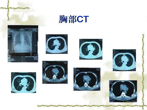 万鳄巨兽 视频海报